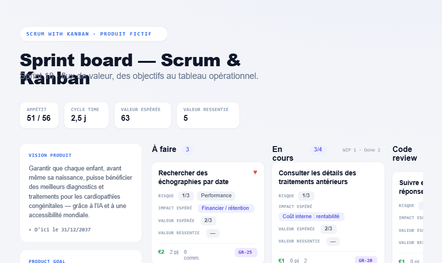 Aperçu du sprint board Scrum/Kanban